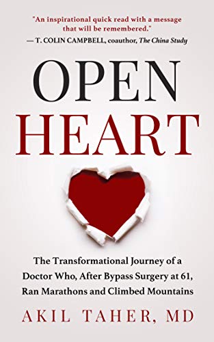 Open Heart on Kindle