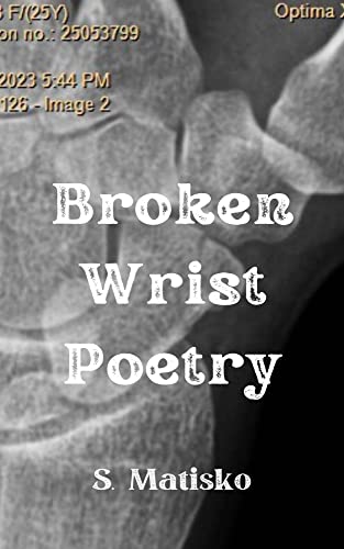 Broken Wrist Poetry on Kindle